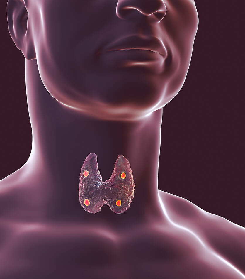 hypoparathyroidism